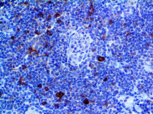 IHC of CD25 on an FFPE Tonsil Tissue